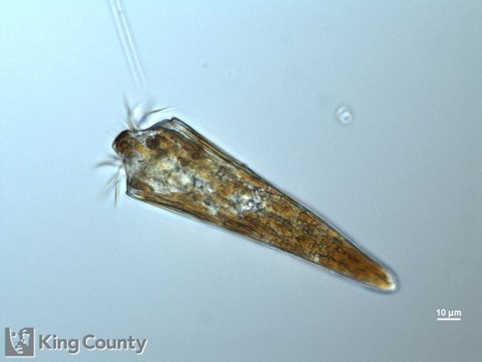 Photo of Strombidium